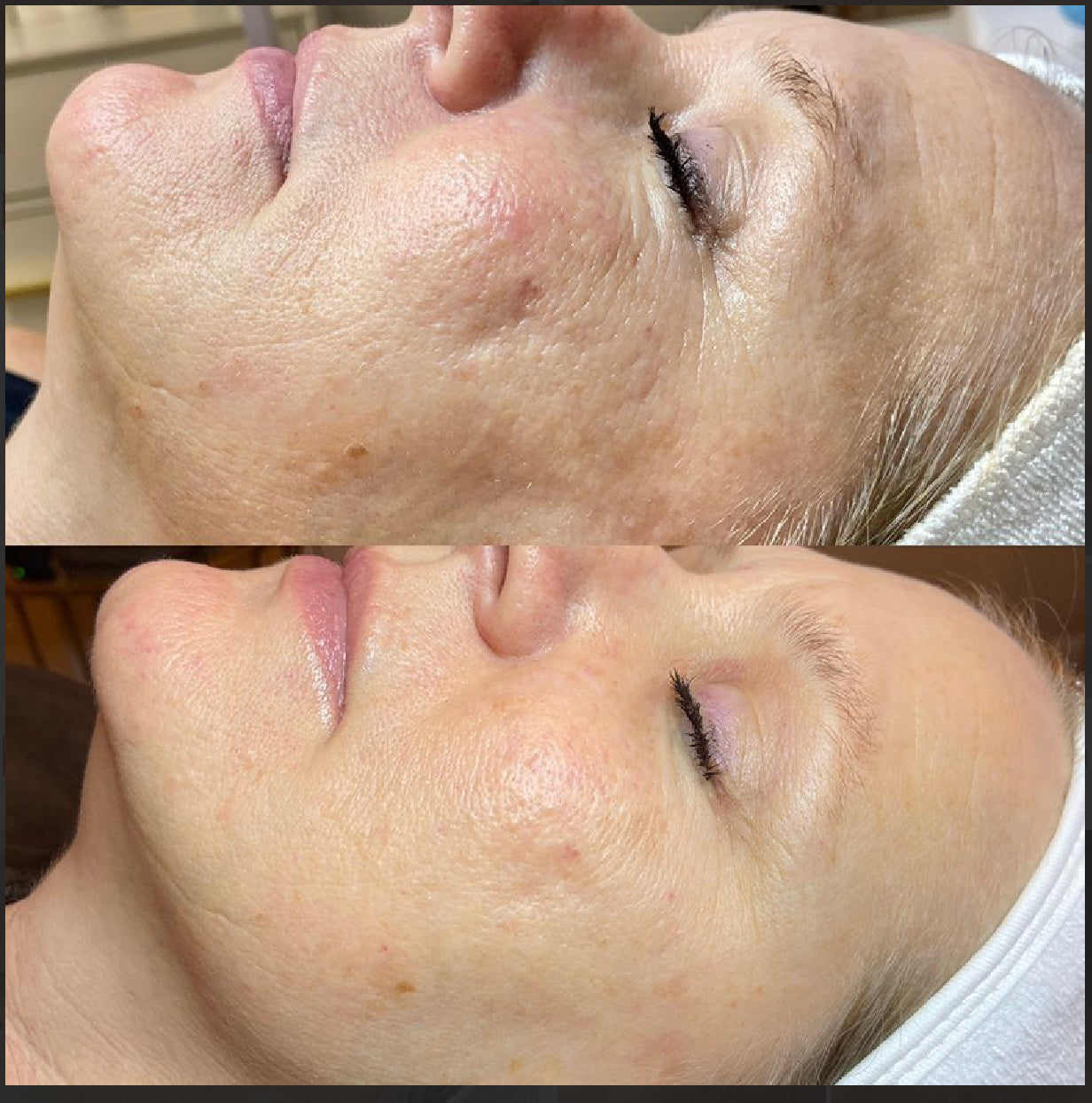 Procell therapies package (6)